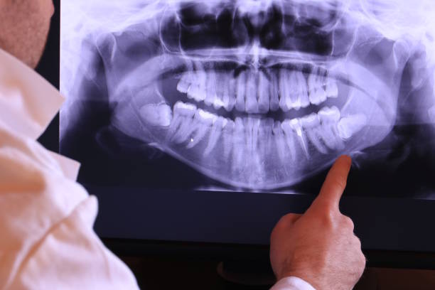 Best Knocked-Out Tooth Emergency  in Rockwall, TX